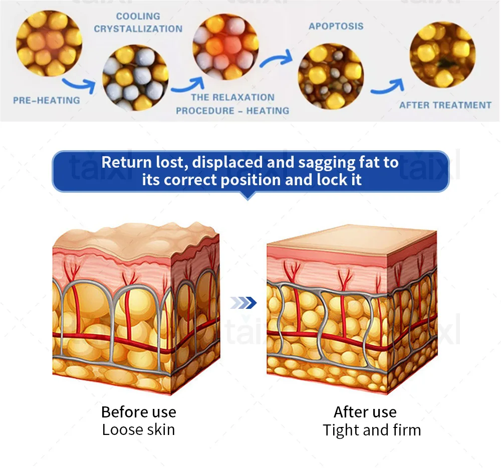 Fat Freezing Slimming Machine Cryolipolysis CoolSculpting Fat Burner Body Massager, Weight Loss Cellulite Removal Cold Therapy Fat Freezing Slimming Machine Cryolipolysis CoolSculpting Fat Burner Body Massager, Weight Loss Cellulite Removal Cold Therapy