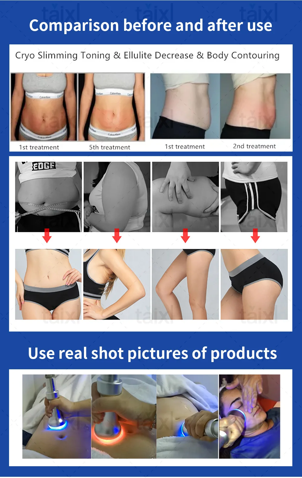 Fat Freezing Slimming Machine Cryolipolysis CoolSculpting Fat Burner Body Massager, Weight Loss Cellulite Removal Cold Therapy Fat Freezing Slimming Machine Cryolipolysis CoolSculpting Fat Burner Body Massager, Weight Loss Cellulite Removal Cold Therapy