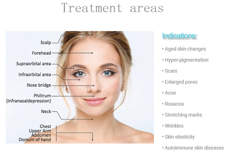 Mezoroller Derma Roller DRS 540 Needle Microneedling for Skin Care Body Treatment Meso Face Dermo Mikronadel Micro Agulha Facial Mezoroller Derma Roller DRS 540 Needle Microneedling for Skin Care Body Treatment Meso Face Dermo Mikronadel Micro Agulha Facial