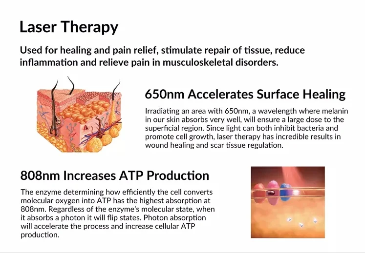 ZJZK 650nm 808nm Portable LLLT Cold Laser Level Therapy Treatment Device for Knee Back Neck Muscle Pain Relief ZJZK 650nm 808nm Portable LLLT Cold Laser Level Therapy Treatment Device for Knee Back Neck Muscle Pain Relief