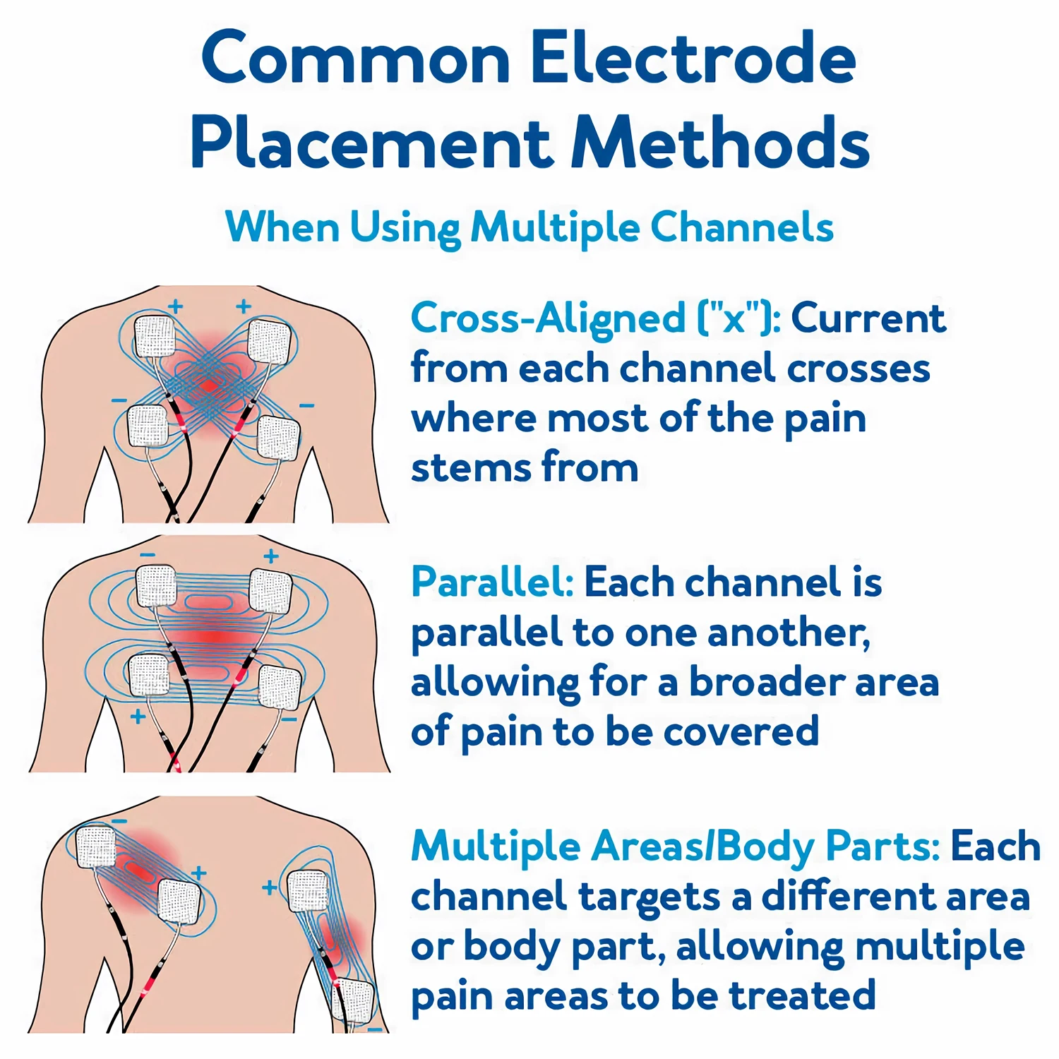 60 Massage Modes 4 In 1 Electric Muscle Stimulator Combo Physiotherapy Therapy 4000Hz EMS IFC RUSS TENS Pulse Electrostimulator 60 Massage Modes 4 In 1 Electric Muscle Stimulator Combo Physiotherapy Therapy 4000Hz EMS IFC RUSS TENS Pulse Electrostimulator