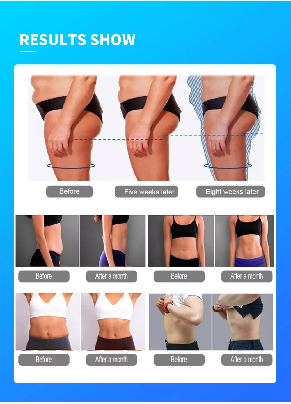 MYOSLIM 6500W 200HZ Roller Slimming Cellulite Reduction Inner Ball Roller 360 Degree Infrared Vacuum Roller Massage Beauty MYOSLIM 6500W 200HZ Roller Slimming Cellulite Reduction Inner Ball Roller 360 Degree Infrared Vacuum Roller Massage Beauty
