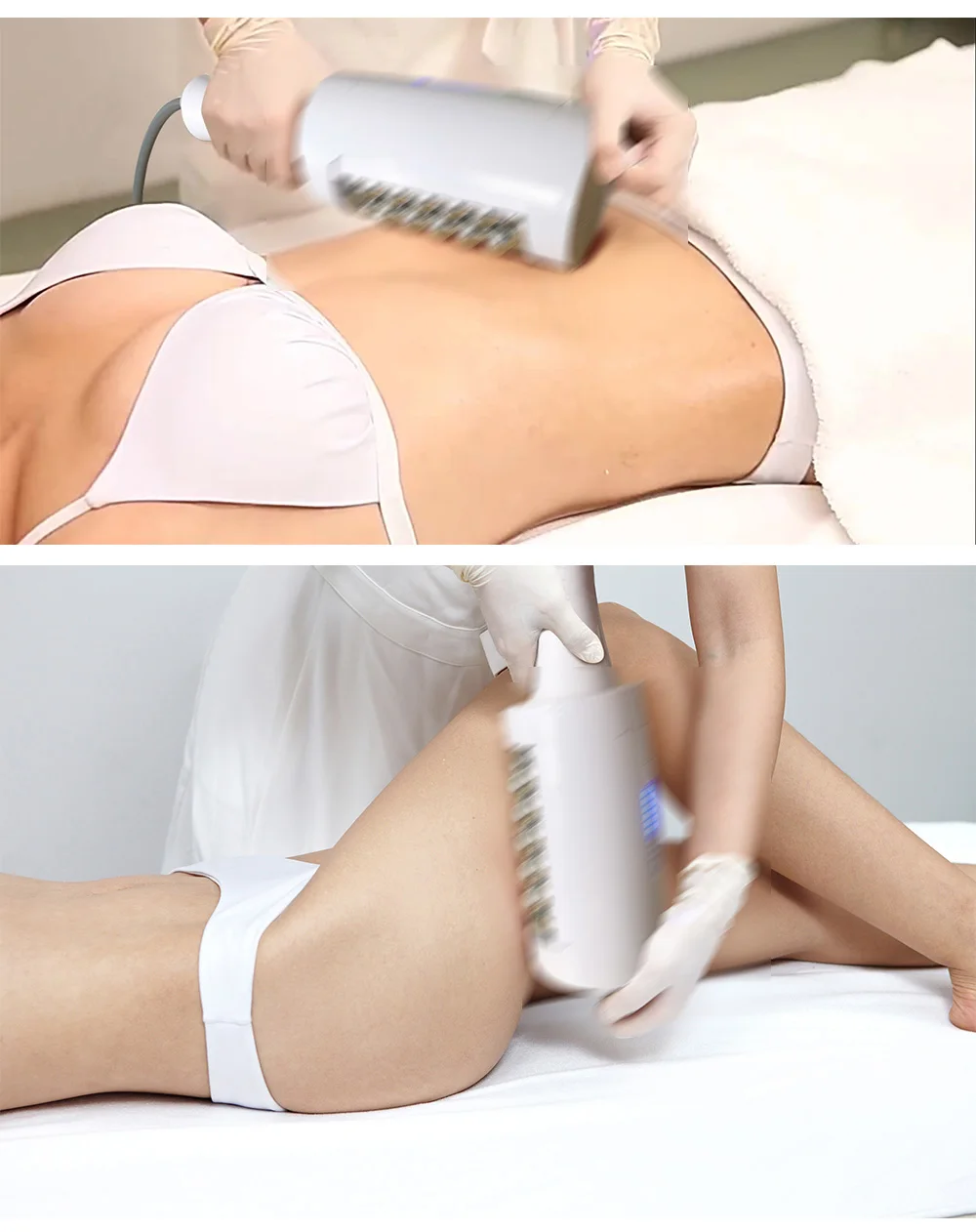 MYOSLIM 6500W 200HZ Roller Slimming Cellulite Reduction Inner Ball Roller 360 Degree Infrared Vacuum Roller Massage Beauty MYOSLIM 6500W 200HZ Roller Slimming Cellulite Reduction Inner Ball Roller 360 Degree Infrared Vacuum Roller Massage Beauty