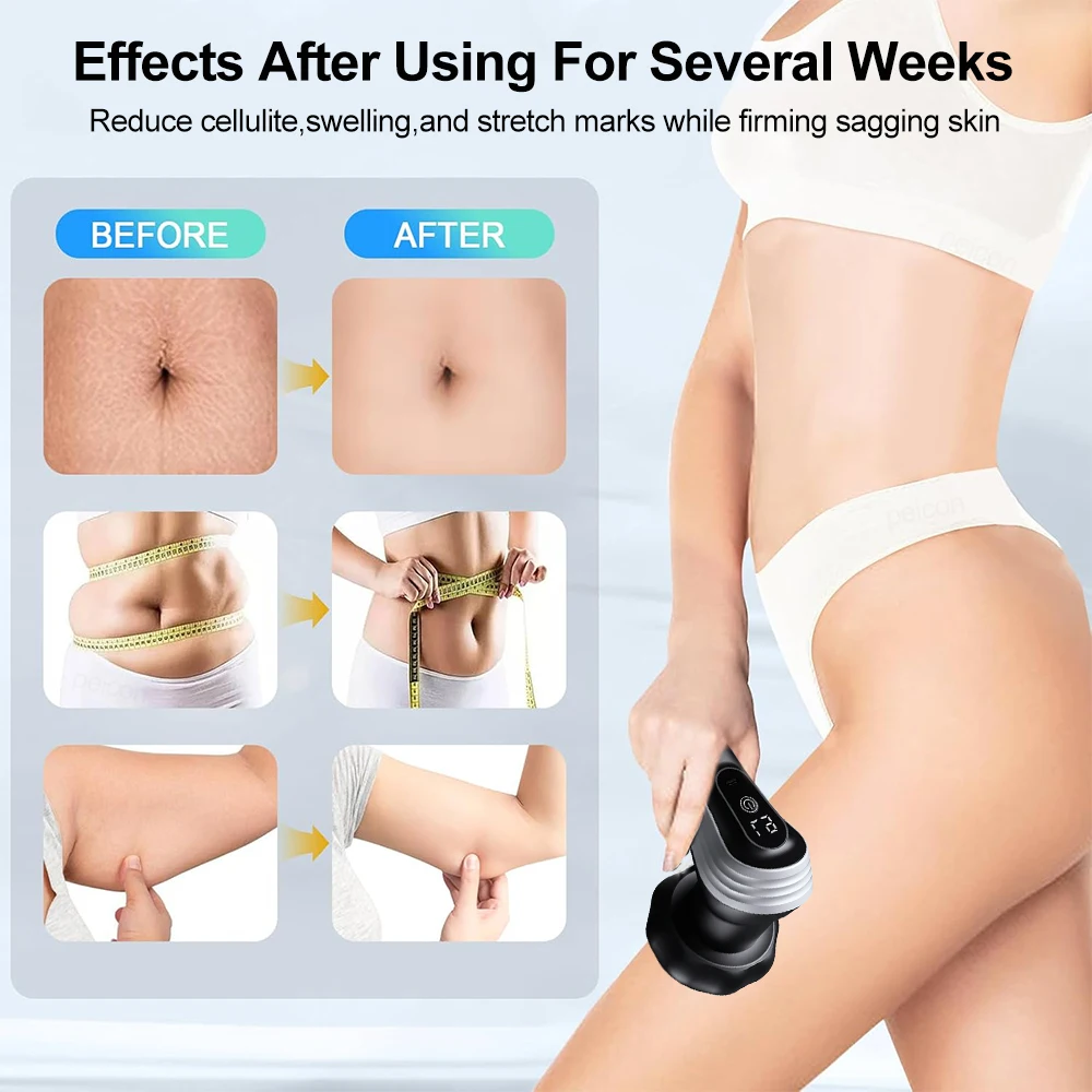 Body Sculpting Machine Electric Body Massager Meridian Dredging and Fat Pushing Machine for Belly Fat Thighs Buttocks Sculpting - Image 6