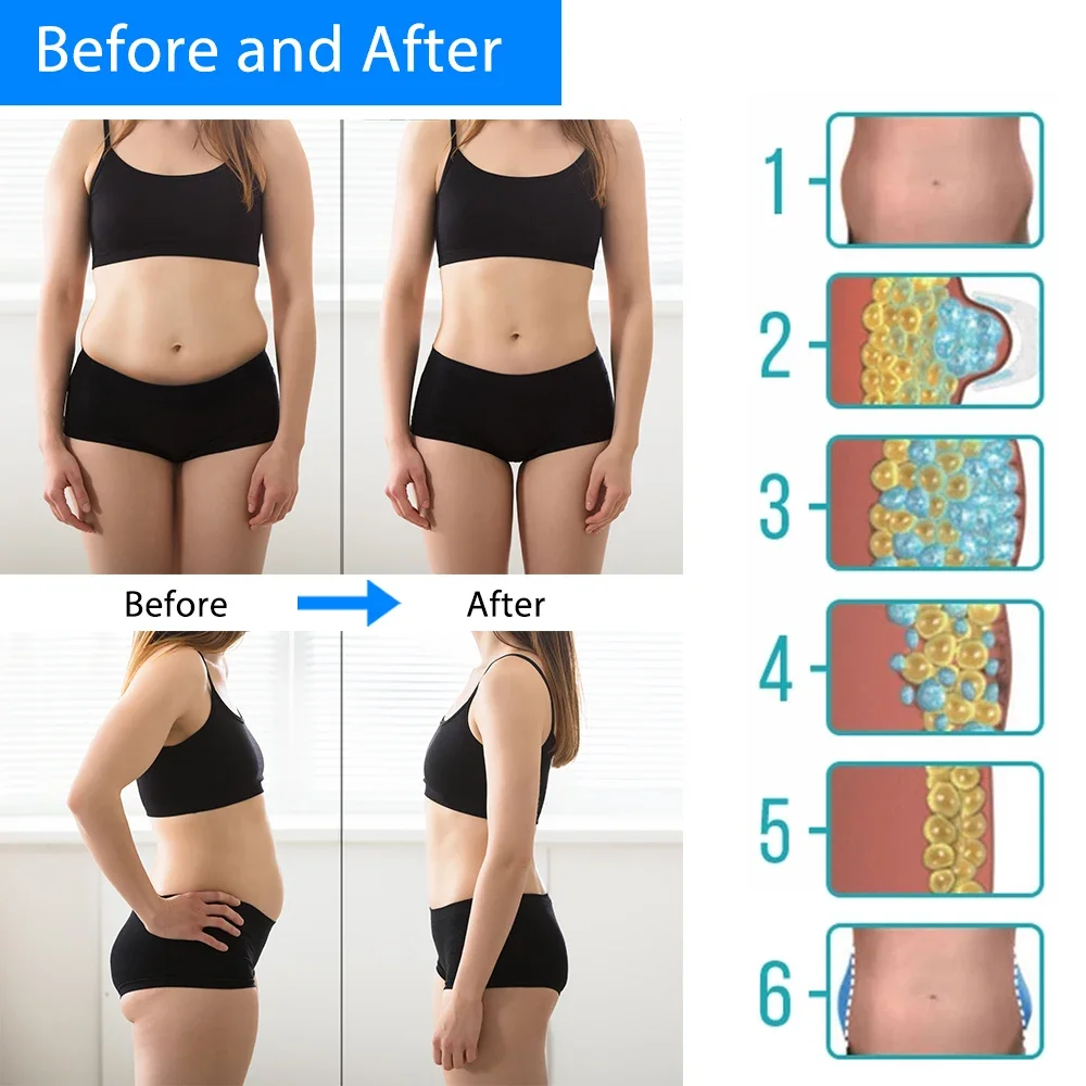 Cryotherapy Dissolve Fat Cold Therapy Anti Cellulite Massager Abdominal Lipo Freeze Machine Fat Lose Body Slimming Criolipolisis Cryotherapy Dissolve Fat Cold Therapy Anti Cellulite Massager Abdominal Lipo Freeze Machine Fat Lose Body Slimming Criolipolisis