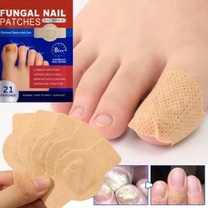 Feet Care Tools 21/105pcs Nail Fungus Patch Waterproof Nail Repair Patch Ingrown Correction Sticker Damaged Nail Gray Care Patch