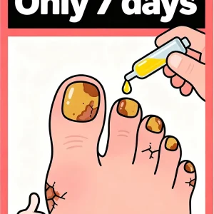 Fast penetration, nails become translucent and fungal free.