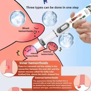 YP1117 Medical Hemorrhoid Laser PenTreat External Internal Hemorrhoids Anus Swelling Pain Relief Laser Pointer Hemorrhoid Treat