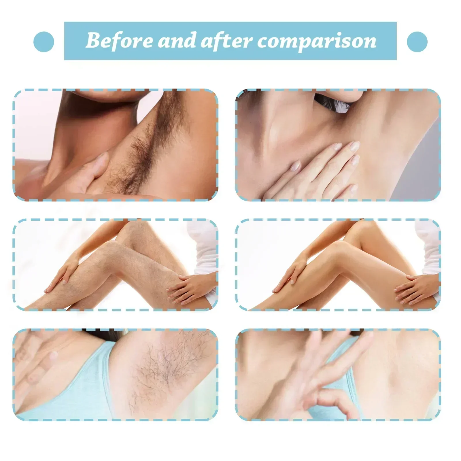 Permanent Hair Inhibition Serum Painless Allantoin Lupine Essence Hair Remover Hair Growth Inhibitor Depilatory Body Cream Care Permanent Hair Inhibition Serum Painless Allantoin Lupine Essence Hair Remover Hair Growth Inhibitor Depilatory Body Cream Care