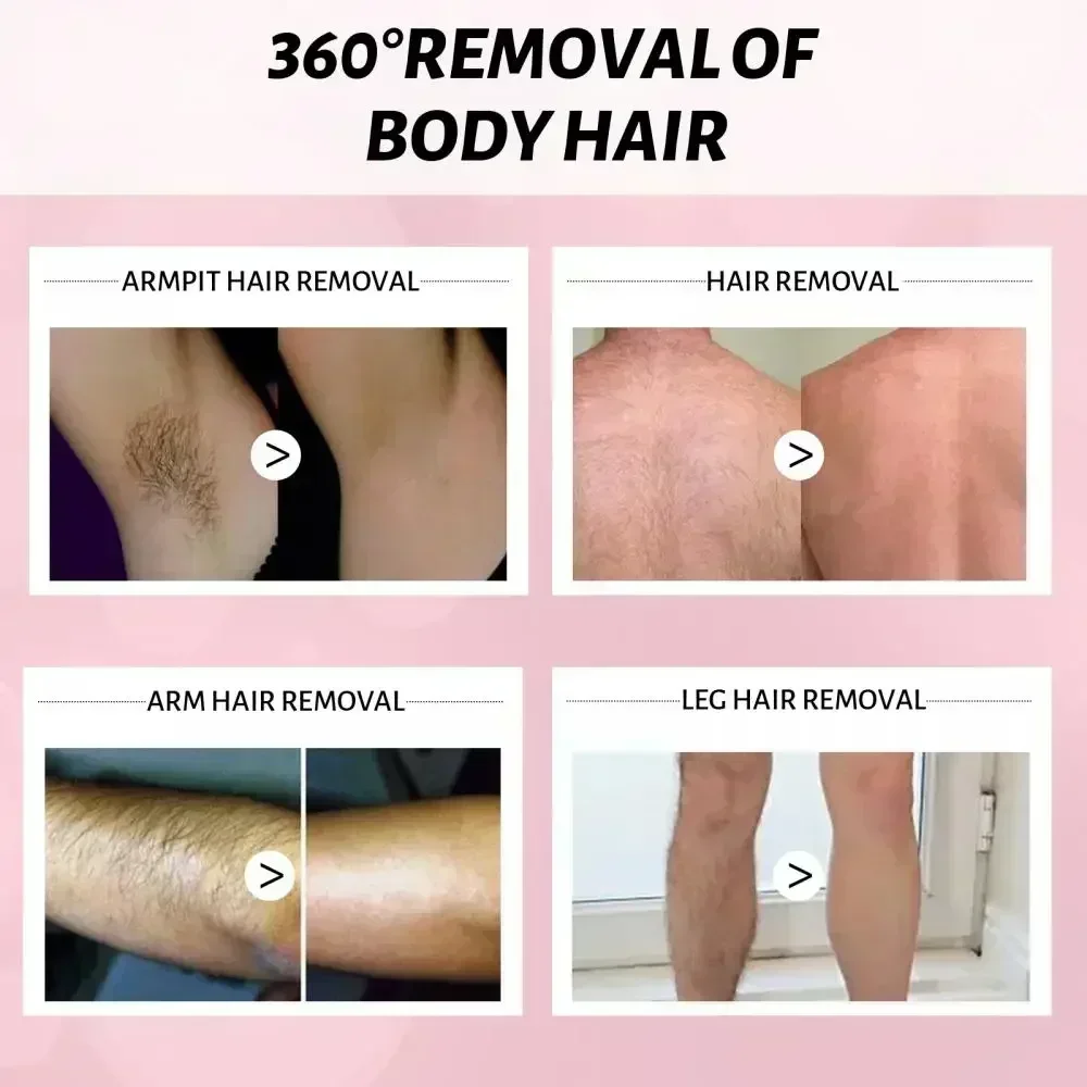 Permanent Hair Inhibition Serum Painless Allantoin Lupine Essence Hair Remover Hair Growth Inhibitor Depilatory Body Cream Care - Image 3