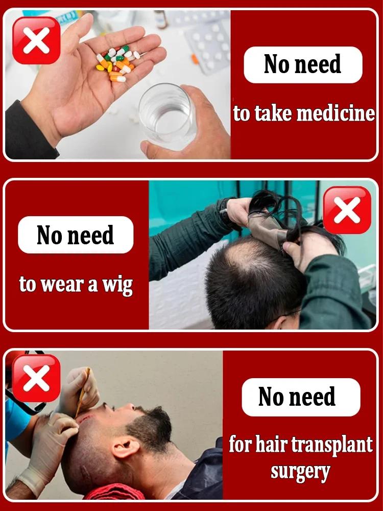 Grow cool hair secretly and surprise everyone. Say goodbye to baldness and hair loss now - Image 5