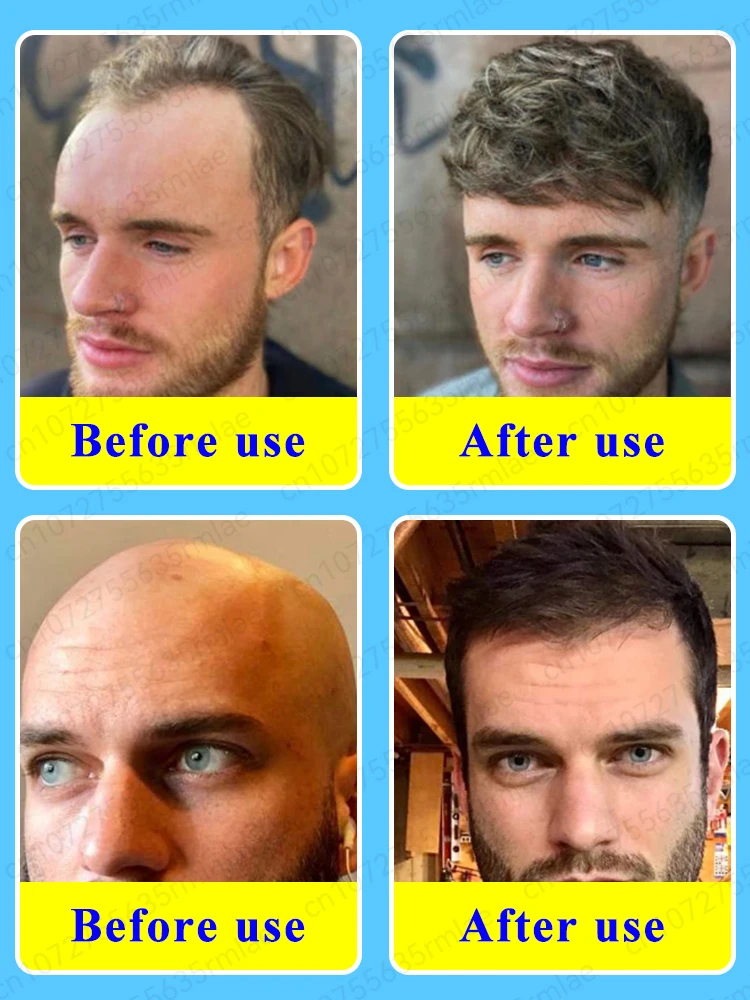 Grow cool hair secretly and surprise everyone. Say goodbye to baldness and hair loss now - Image 2