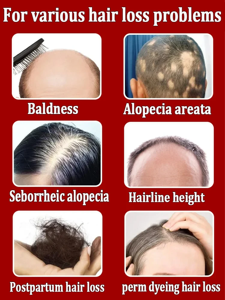 Grow cool hair secretly and surprise everyone. Say goodbye to baldness and hair loss now - Image 4