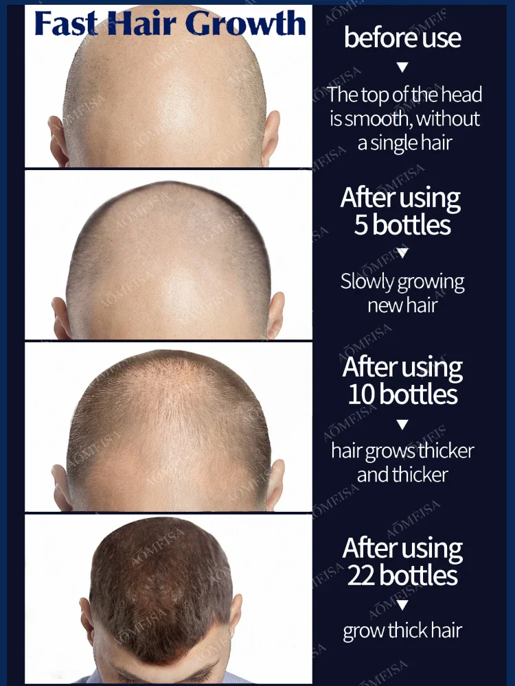 Grow cool hair secretly and surprise everyone. Say goodbye to baldness and hair loss now - Image 6
