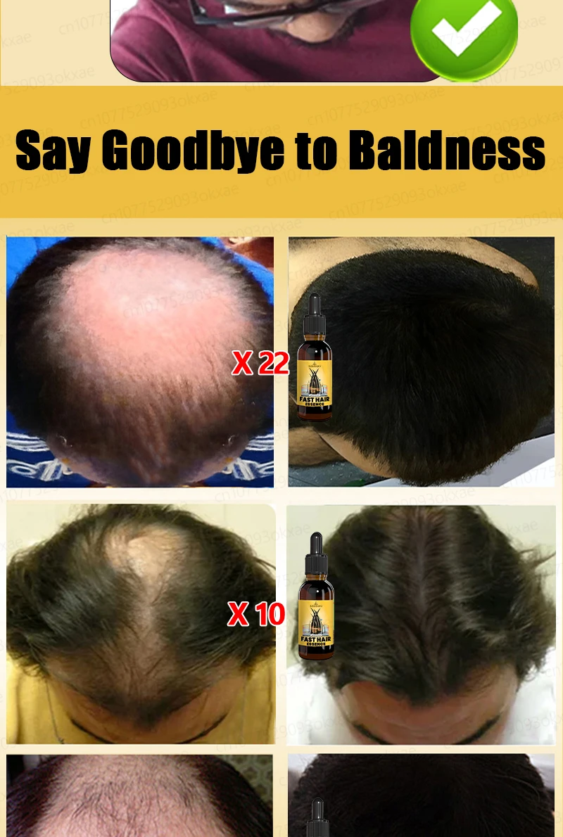 Grow cool hair secretly and surprise everyone. Say goodbye to baldness and hair loss now Grow cool hair secretly and surprise everyone. Say goodbye to baldness and hair loss now