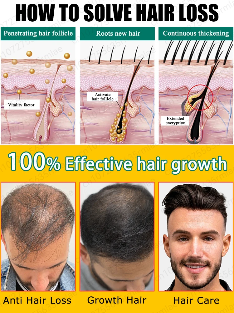 Grow cool hair secretly and surprise everyone. Say goodbye to baldness and hair loss now - Image 3
