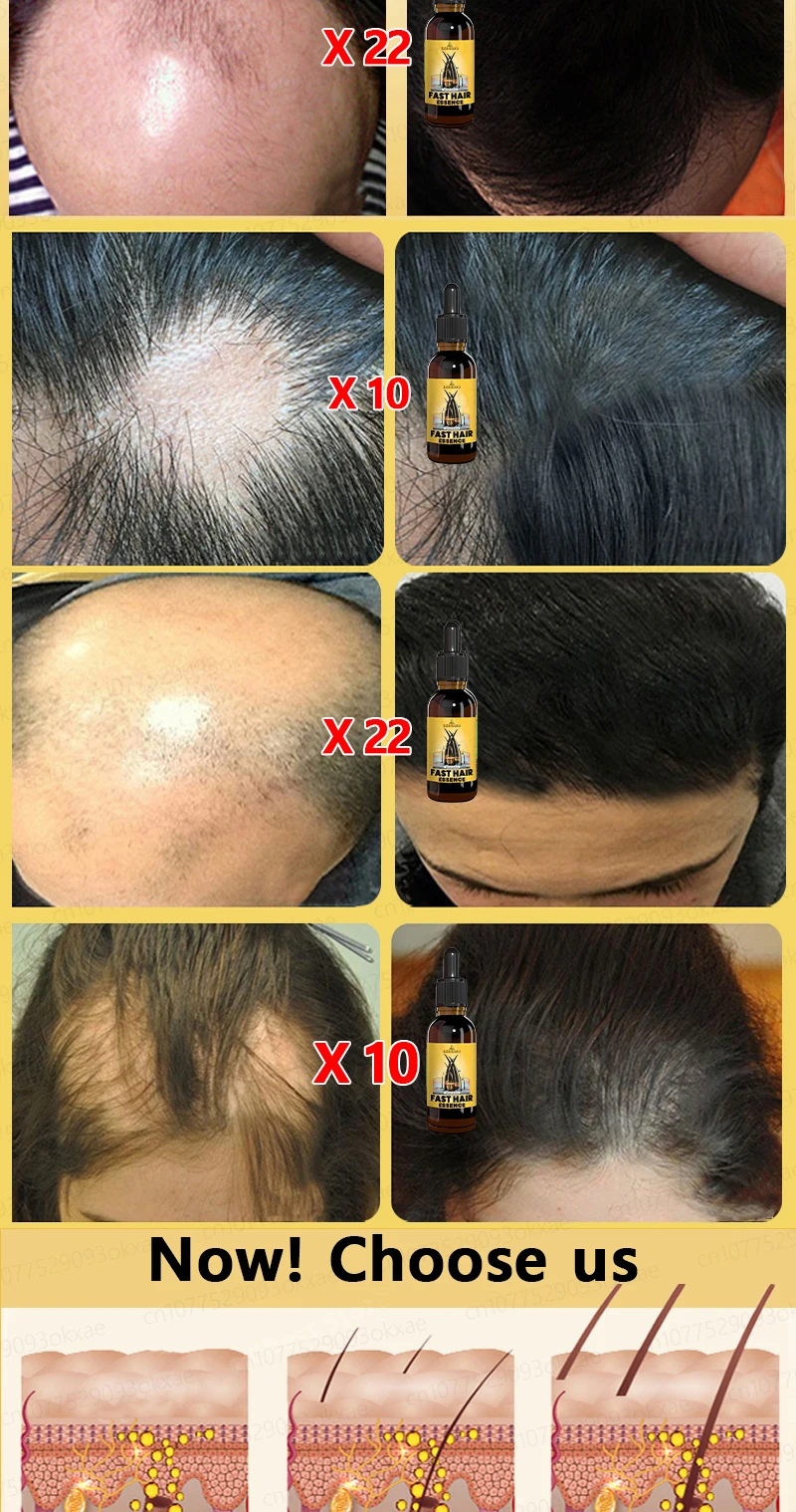 Grow cool hair secretly and surprise everyone. Say goodbye to baldness and hair loss now Grow cool hair secretly and surprise everyone. Say goodbye to baldness and hair loss now