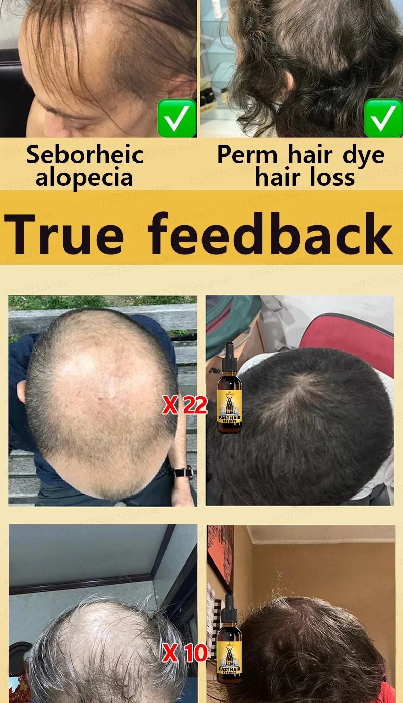 Grow cool hair secretly and surprise everyone. Say goodbye to baldness and hair loss now Grow cool hair secretly and surprise everyone. Say goodbye to baldness and hair loss now