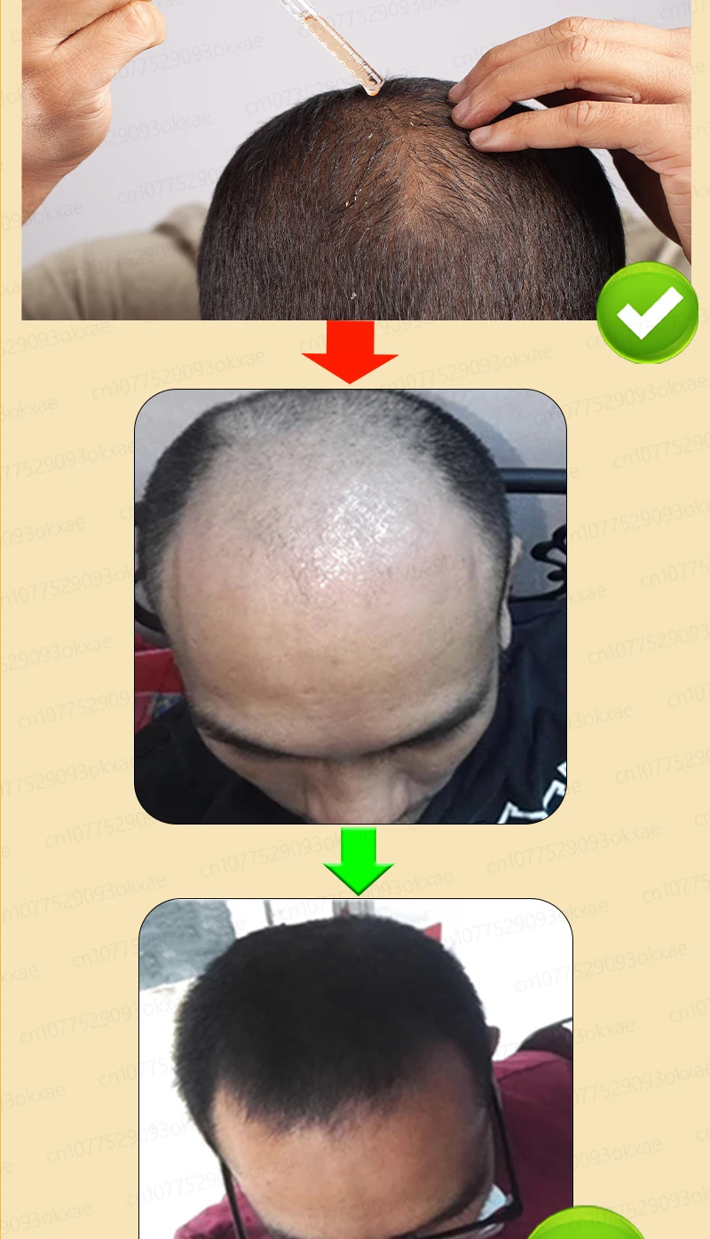 Grow cool hair secretly and surprise everyone. Say goodbye to baldness and hair loss now Grow cool hair secretly and surprise everyone. Say goodbye to baldness and hair loss now