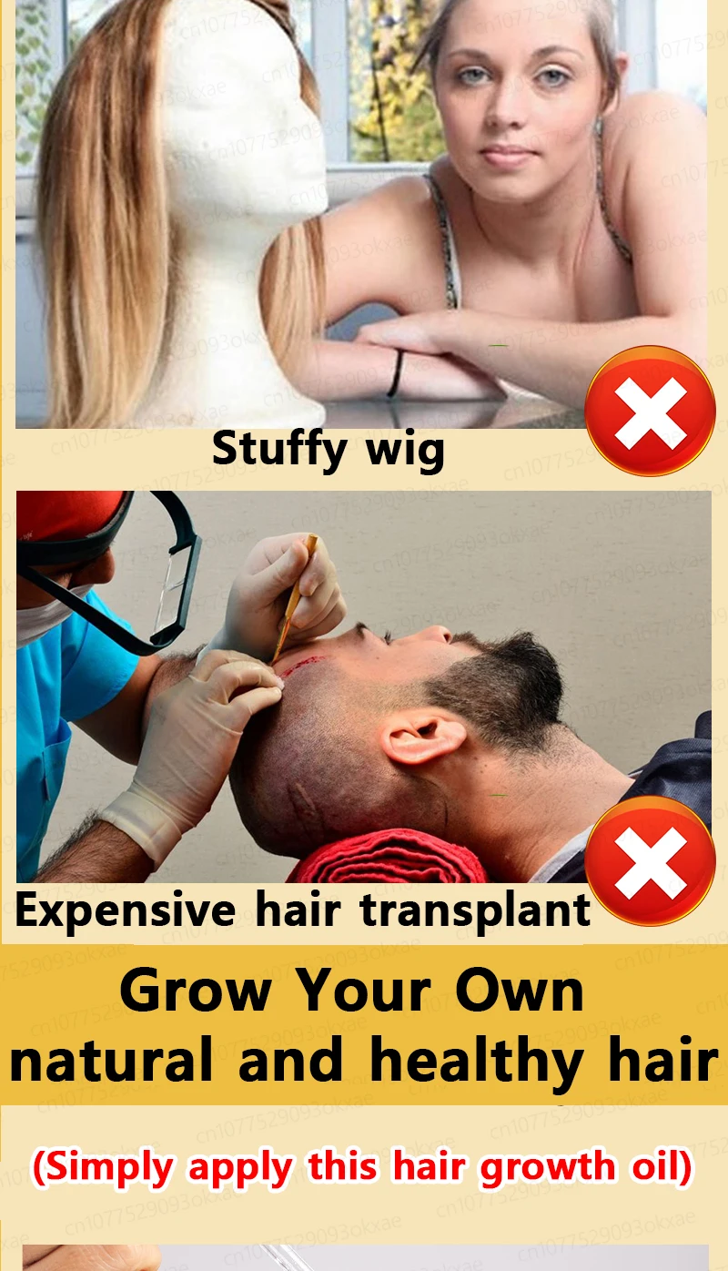 Grow cool hair secretly and surprise everyone. Say goodbye to baldness and hair loss now Grow cool hair secretly and surprise everyone. Say goodbye to baldness and hair loss now
