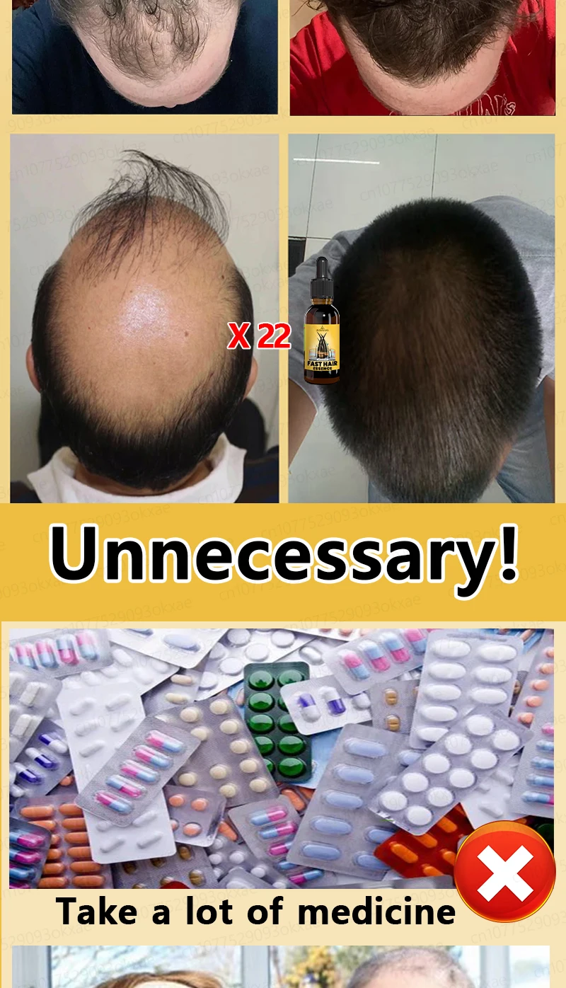 Grow cool hair secretly and surprise everyone. Say goodbye to baldness and hair loss now Grow cool hair secretly and surprise everyone. Say goodbye to baldness and hair loss now