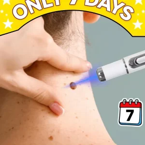 2026NEW blue light pen to solve neck warts, wart care tools