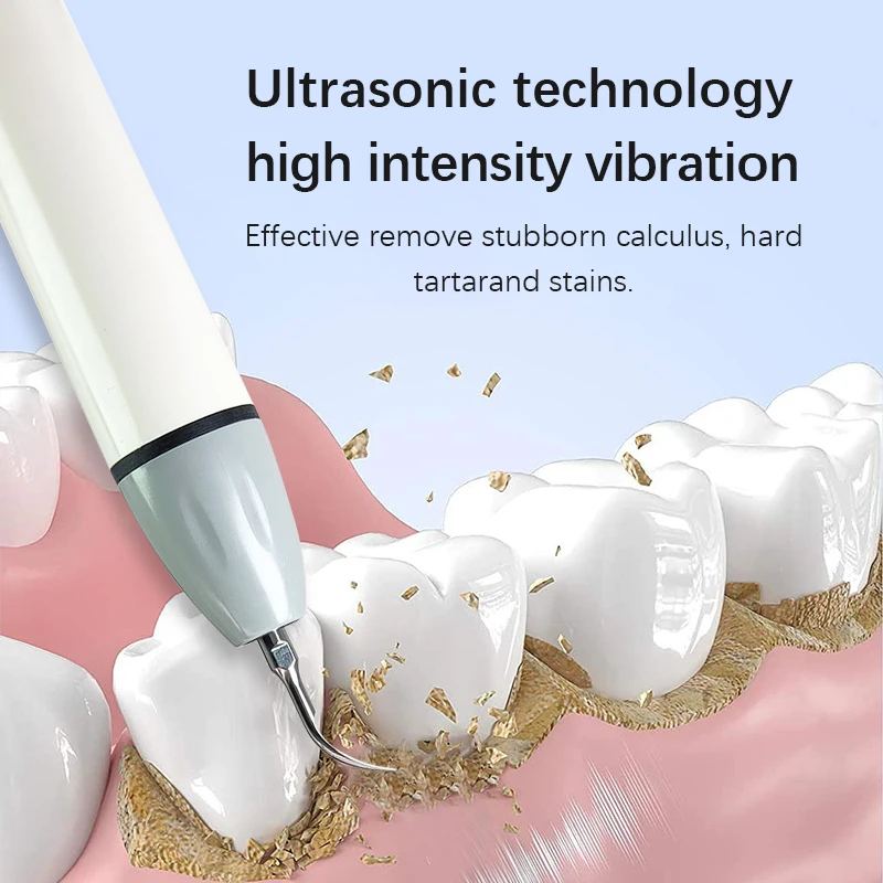 Woodpecker DTE D7 LED Ultrasonic Scaler Prevent Dental Disease Fiber Optics Portable Teeth Whitening Cleaning Dental Equipment - Image 4
