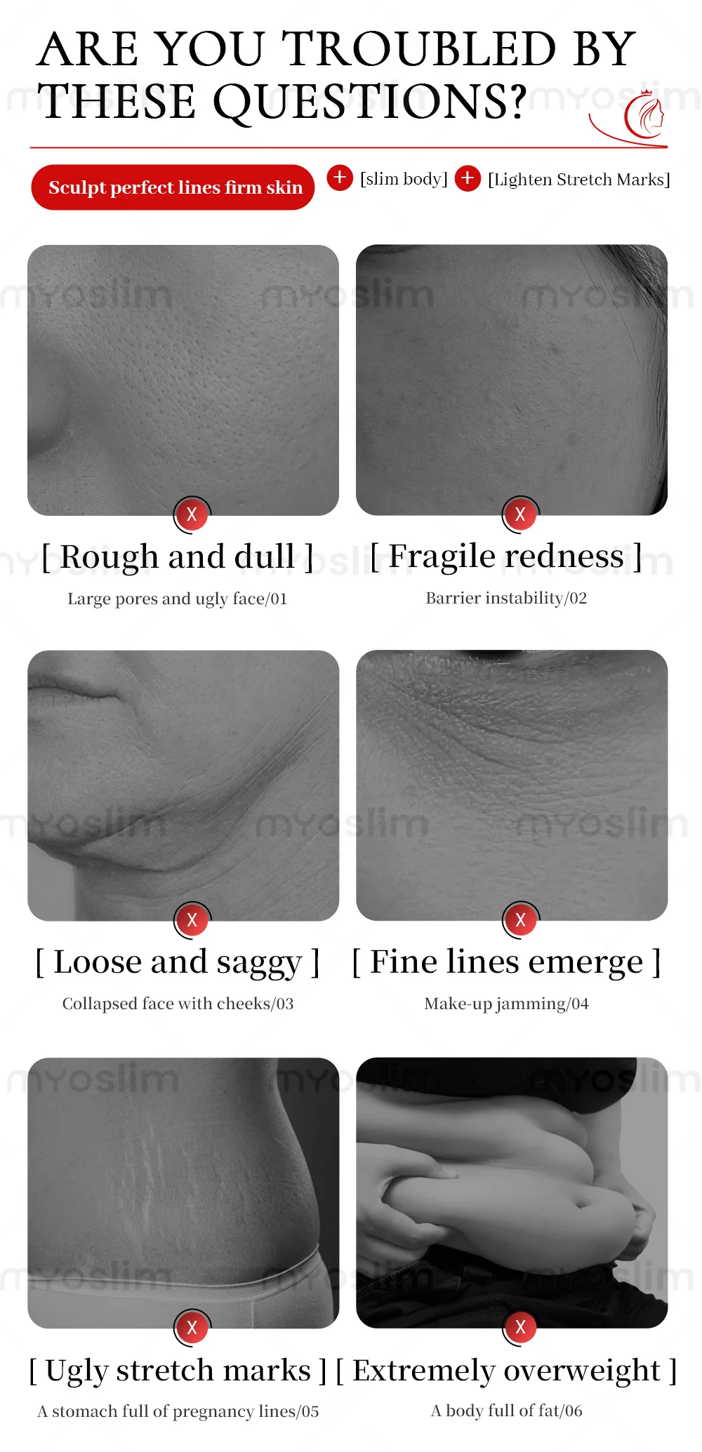 4D Multi-Function RF + Vacuum Roller Body Sculpting Machine – Skin Tightening Cellulite Removal & Muscle Stimulation All-in-One