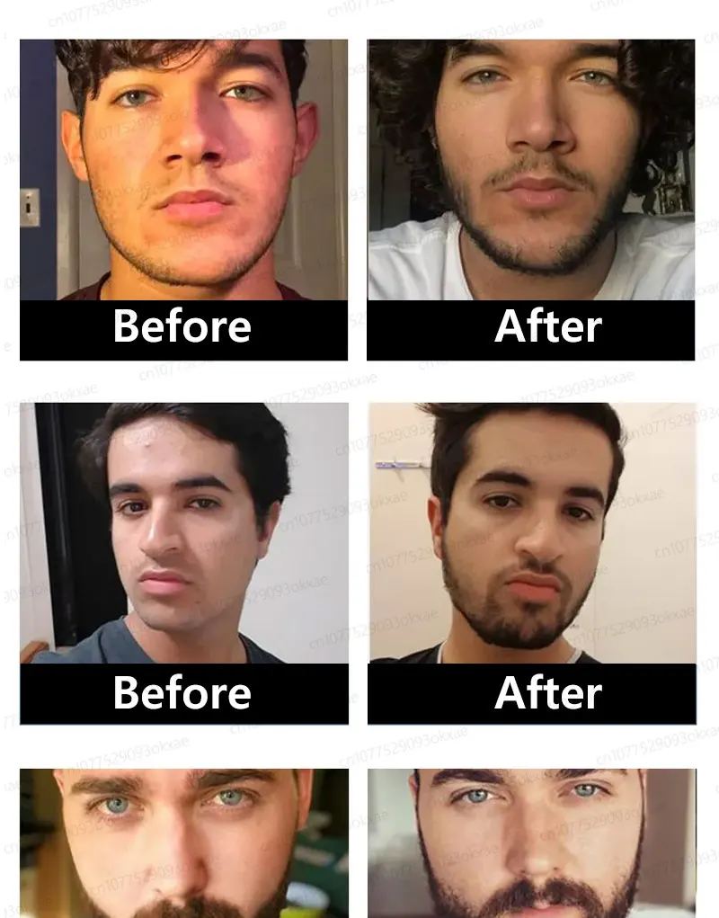 Make your beard thicker, longer and more mature with the latest beard growth liquid in 2025. Make your beard thicker, longer and more mature with the latest beard growth liquid in 2025.