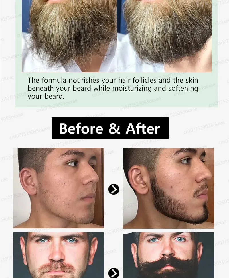 Make your beard thicker, longer and more mature with the latest beard growth liquid in 2025. Make your beard thicker, longer and more mature with the latest beard growth liquid in 2025.