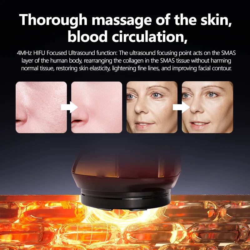 Newest 4 IN 1 Mini HIFU Machine 3nd Generation EMS Pulse Warm Up Facial Massager for Faces and Body Ultrasound Beauty Device - Image 6