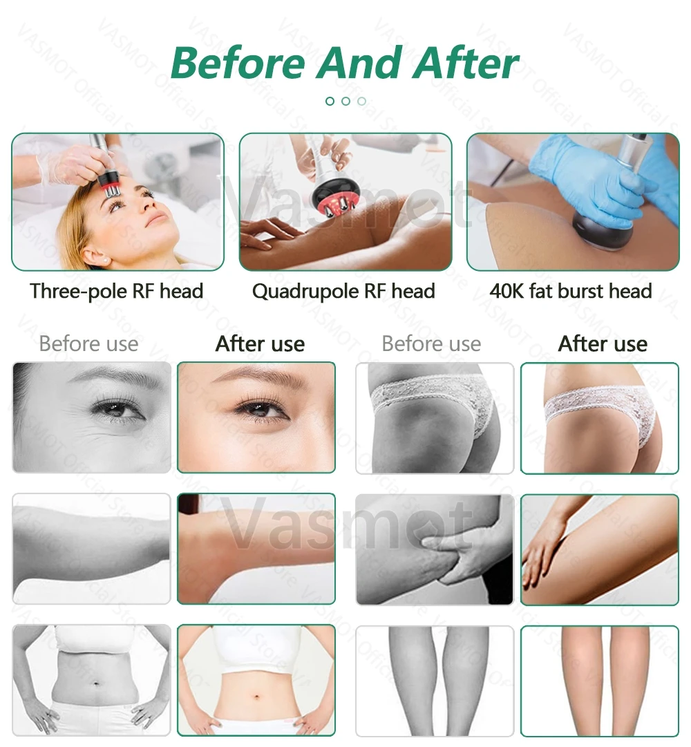 40K RadioFrequency Multifunctional Body Sculpting 6/9IN1 Cavitation Vacuum Massage Device Body Shape Lipo Laser Slimming Machine